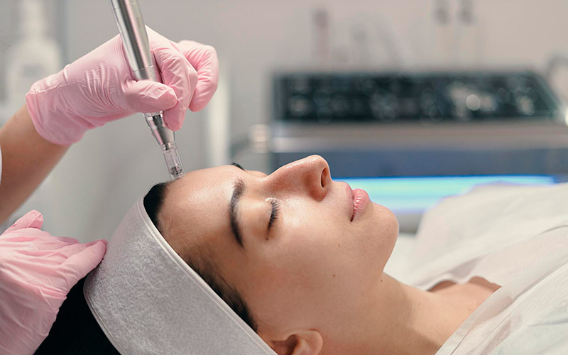 Botox y rellenos faciales